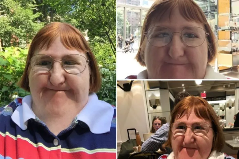 American Blogger Told She's 'Too Ugly' to Post Photos Fights Back, Receives Flood of Support