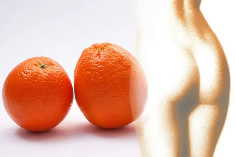 Tired of Cellulite? These Remedies Could Be Your Answer