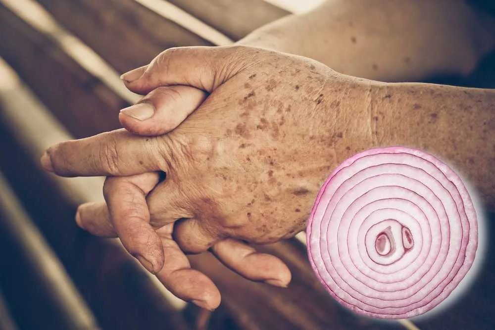 Say Goodbye to Age Spots: A Simple Home Remedy That Works