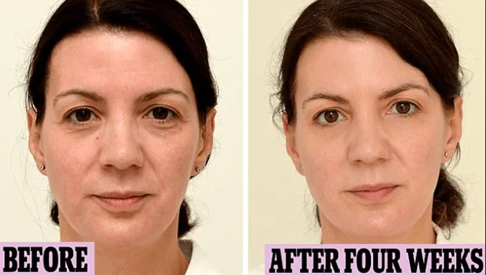 Wow: She Drank Only Water for a Month and This Is What Happened