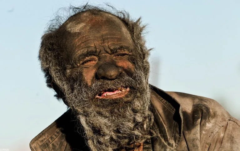 Unwashed for 65 Years: The Man Who Refuses to Bathe