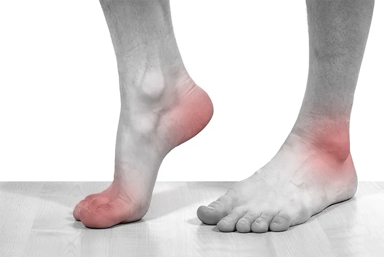 This Everyday Drink May Help Relieve or Even Cure Your Gout