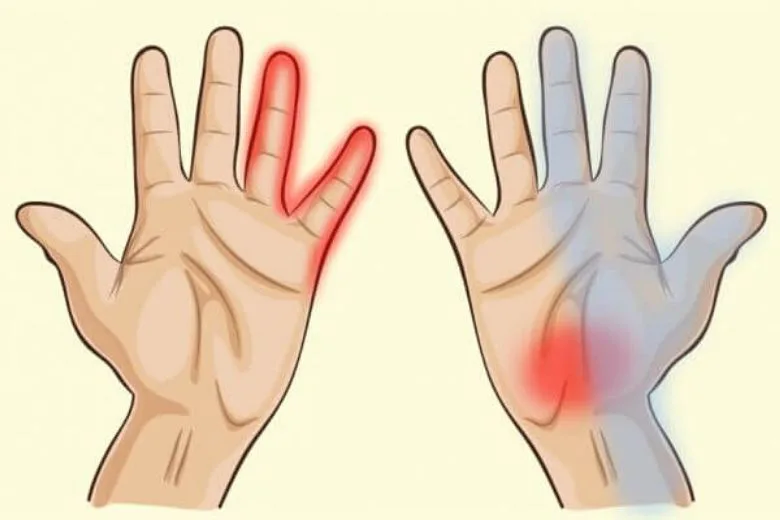 What Your Hands Reveal About Your Health: Key Signs to Watch For