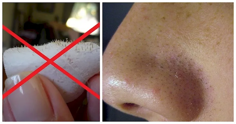 Indulge in a Home Spa Day with This Natural Cleanser, and You'll Never Need Nose Strips Again!