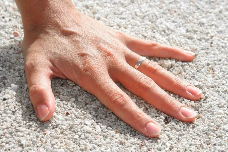 Doctor-Approved Hack to Remove a Stuck Ring Without Damaging It