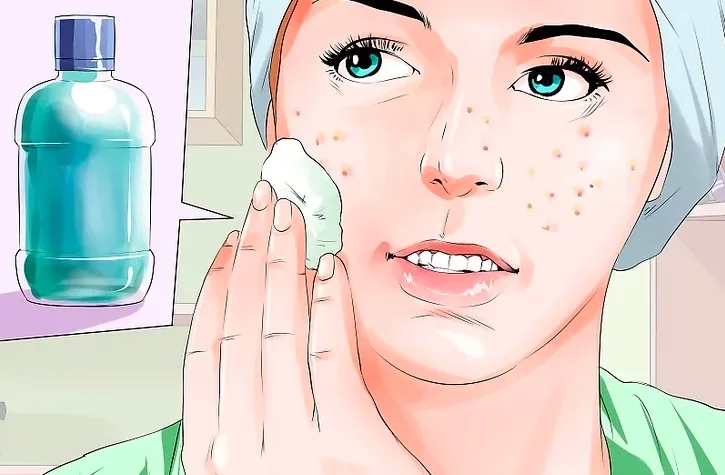 Surprising Uses for Mouthwash: Say Goodbye to Pimples Fast!
