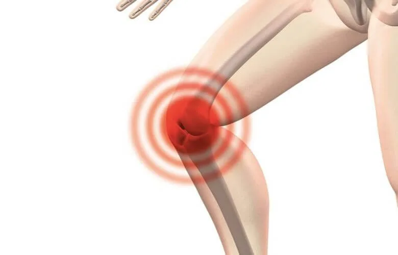 Snapping Knees: What They Mean and How to Fix Them