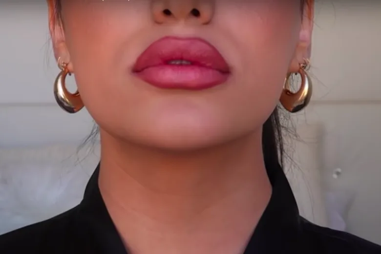 Teens Try Strange New Trick for Plumper Lips
